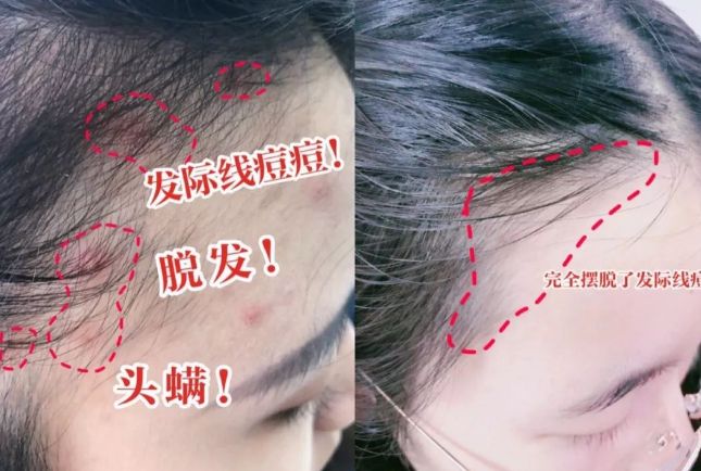 10分钟轻松养成女明星「绸缎发」新葡京洗完头自然风干还是吹干好？(图20)